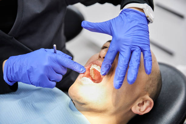 Best Emergency Dental Care for Broken or Chipped Teeth in Fraser, MI